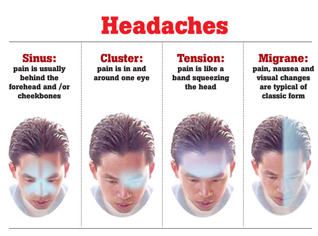 headache across forehead