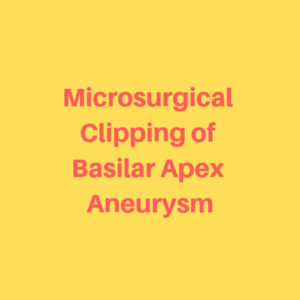 Microsurgical-Clipping-of-Basilar-Apex-Aneurysm