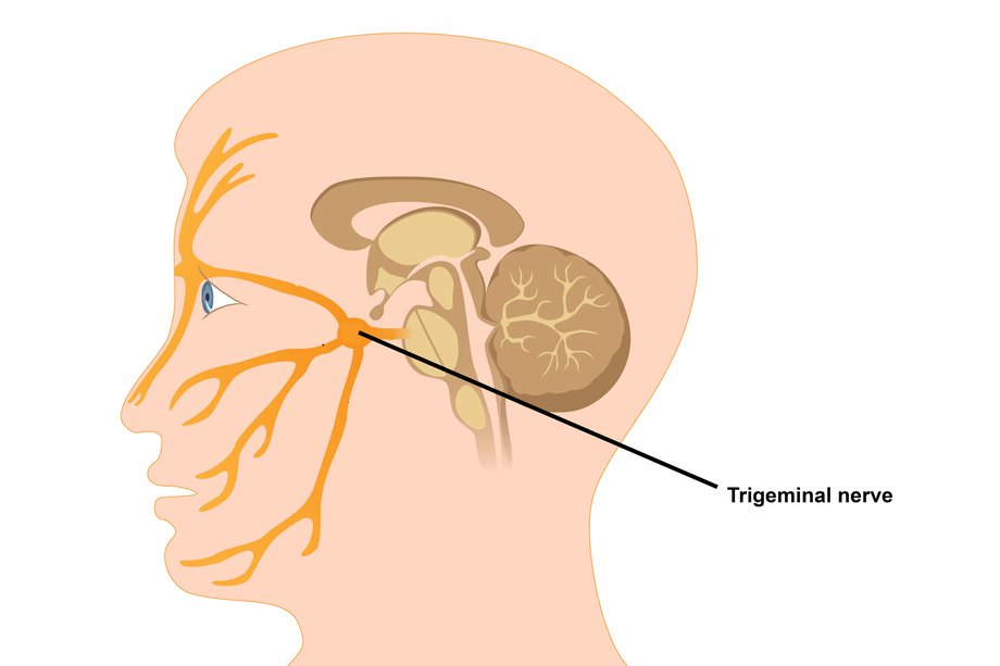 Trigeminal Neuralgia neuro doctors